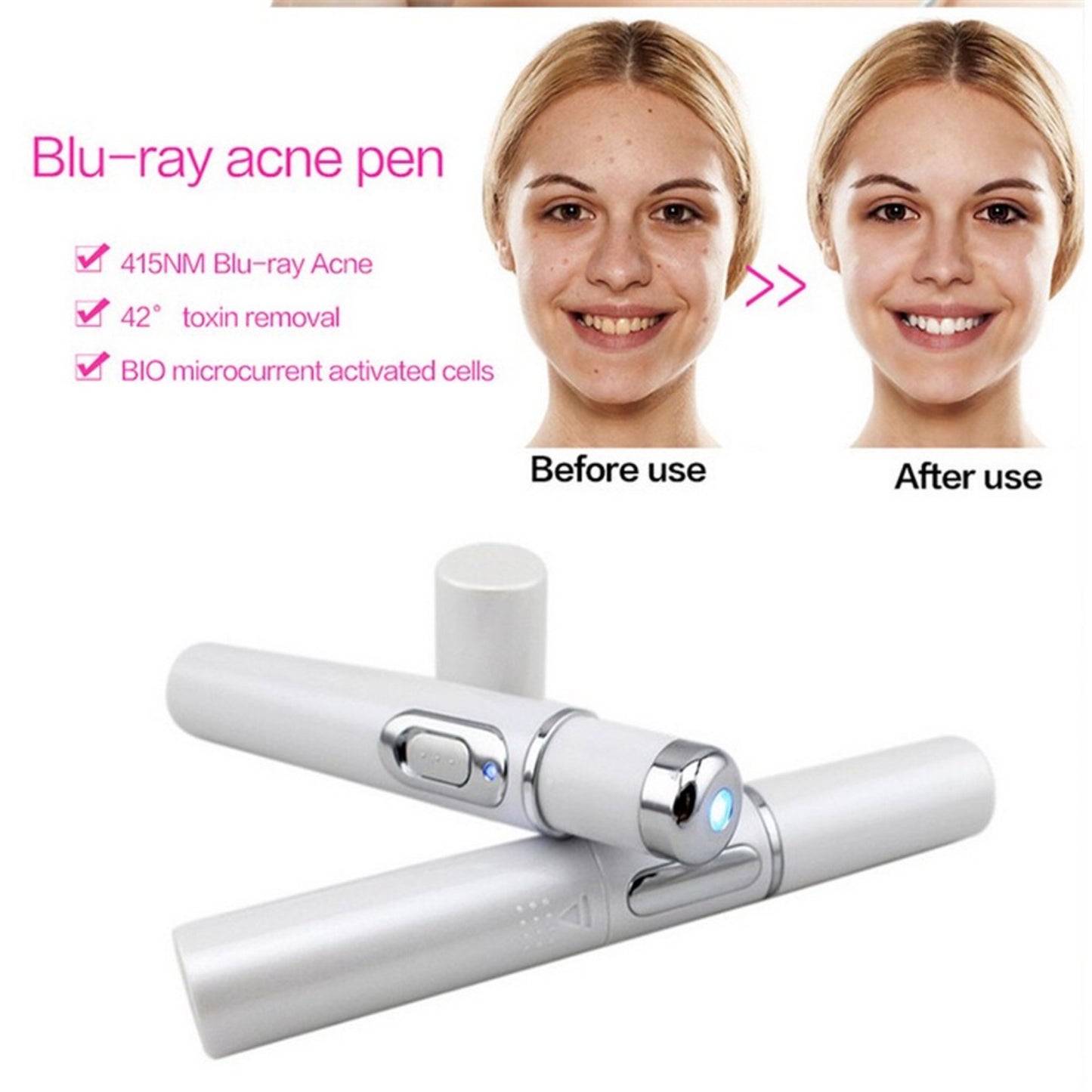 Blue Light Therapy Acne Treatment