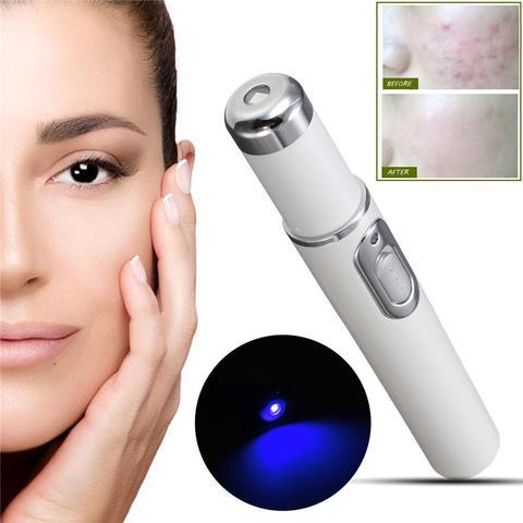 Blue Light Therapy Acne Treatment